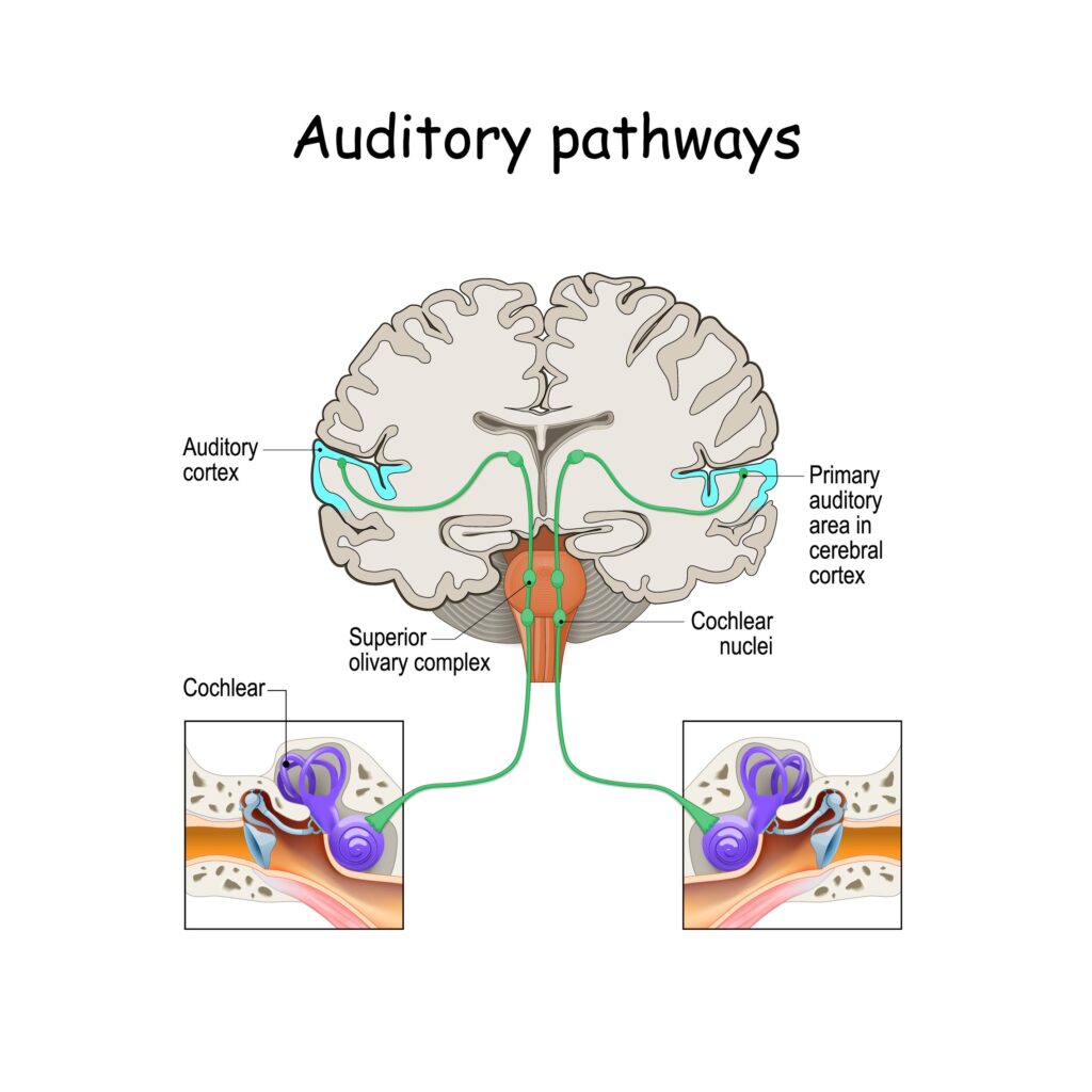 뇌가 쪼그라드는 것을 막는 보청기 신경 회로망
