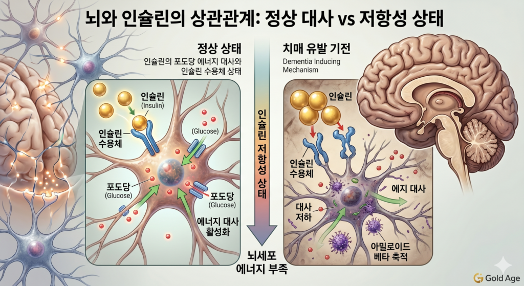 제3형 당뇨와 치매 예방 원리, 뇌세포 인슐린 저항성과 아밀로이드 베타 축적 과정 인포그래픽 (Gold Age)